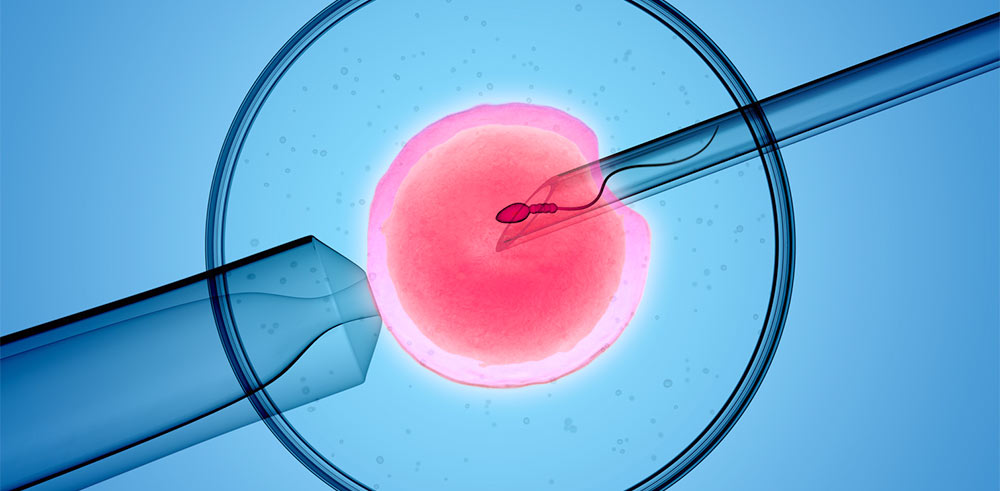 La fcondation in vitro