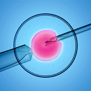 La fcondation in vitro