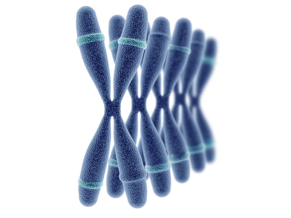Les anomalies chromosomiques - trisomie